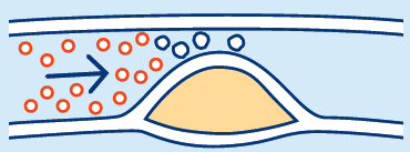 لوحة (الأنسجة الدهنية)